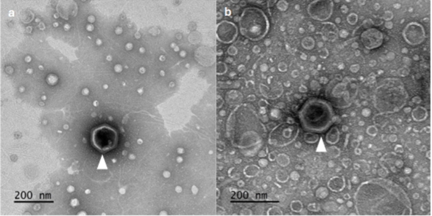 The Invisible Ocean War: How Tiny Viruses Shape Our Planet’s Climate