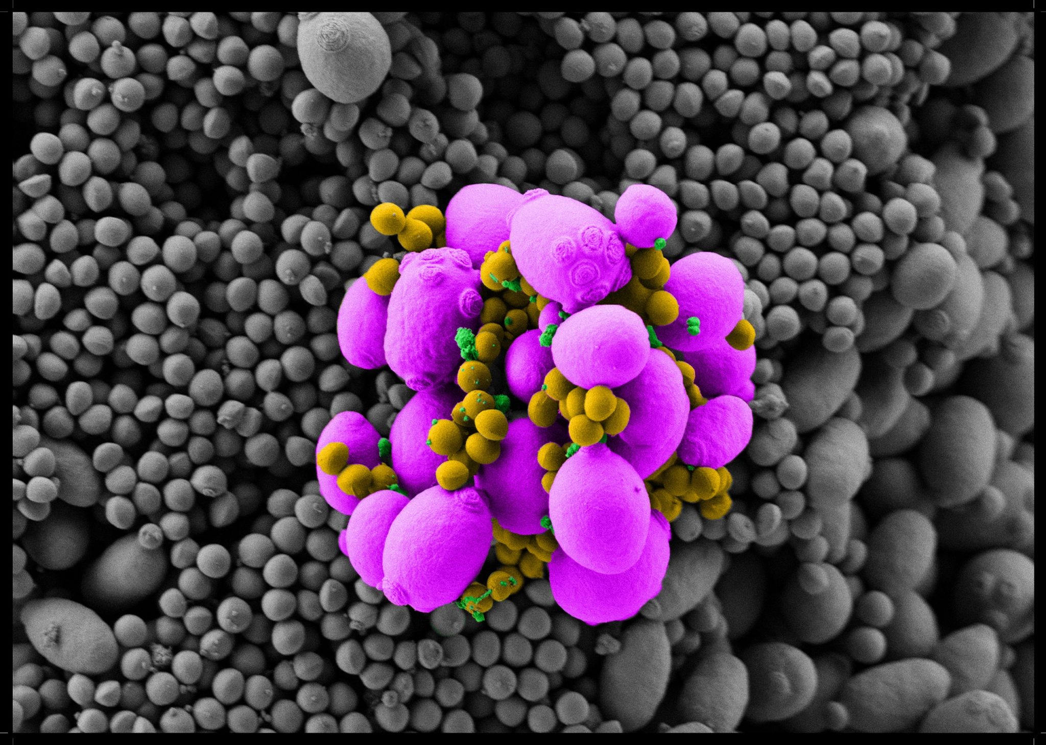 Discover 'The Hidden World of Killer Fungi' through a fascinating new ...