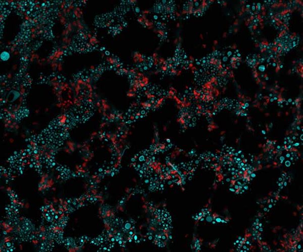 Tiny fungal titanides cells found to play major role in infection