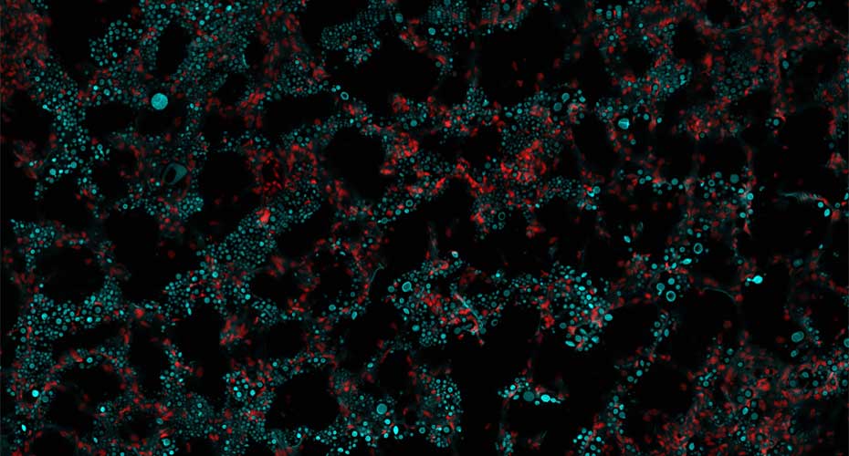 Tiny fungal titanides cells found to play major role in infection