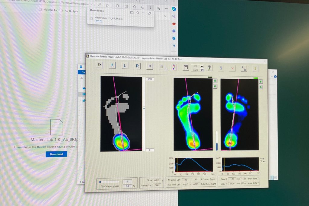 Photo of a computer screen showing highlighted diagrams of a study participant's feet.